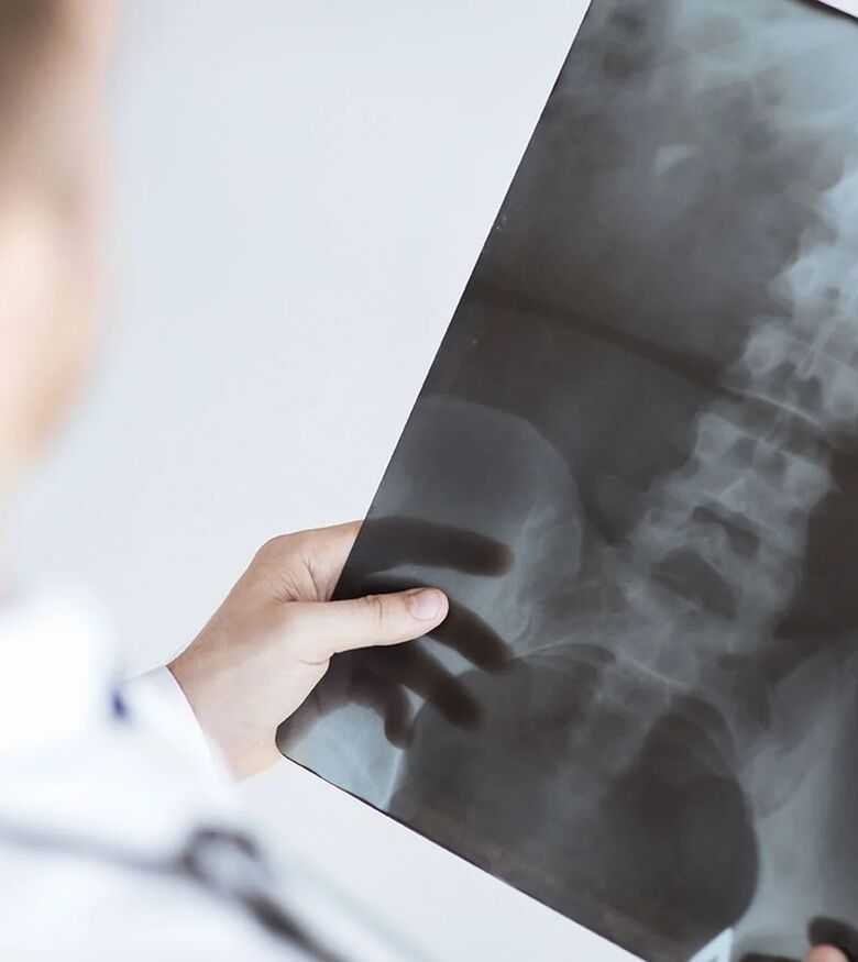 Spinal cord injury attorney examining an X-ray of the human vertebral column